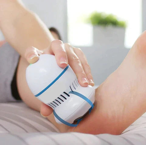 Wellvora Vacuum Callus Remover
